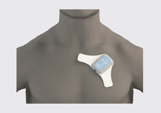 ECG & Holter equipment